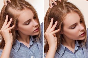 رازهای مراقبت از موهای کم‌پشت در اراک